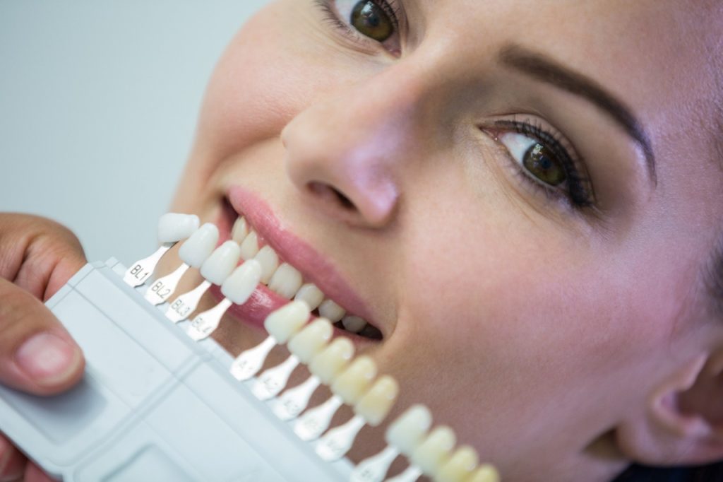 dental plaque