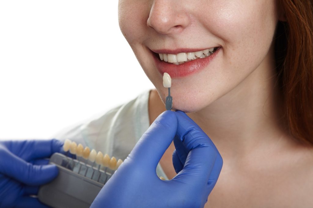 Malocclusion
