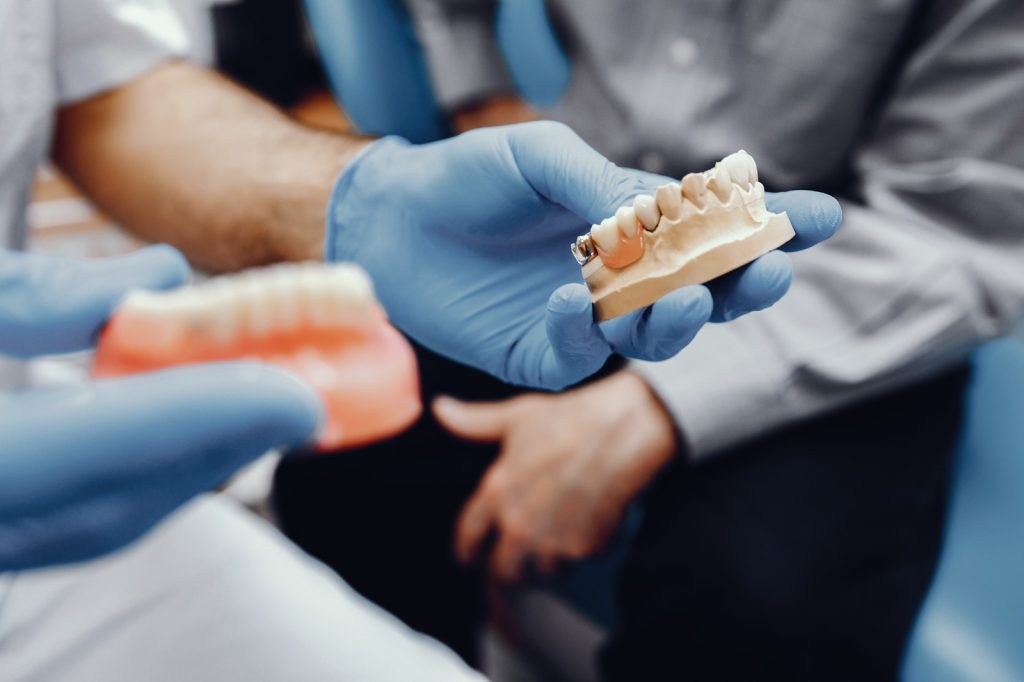 Dental Sealants