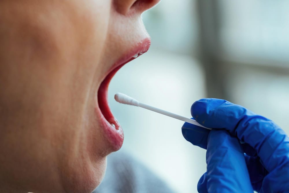 What are Tonsil Stones